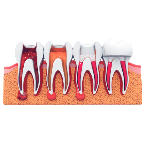 https://toothclubclinic.com/wp-content/uploads/2025/03/ขนาด-578800-px-3.png