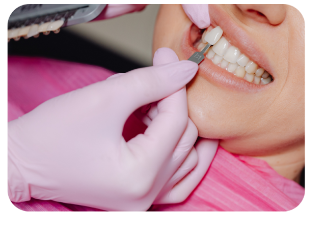 https://toothclubclinic.com/wp-content/uploads/2025/08/วีเนียร์-640x462.png