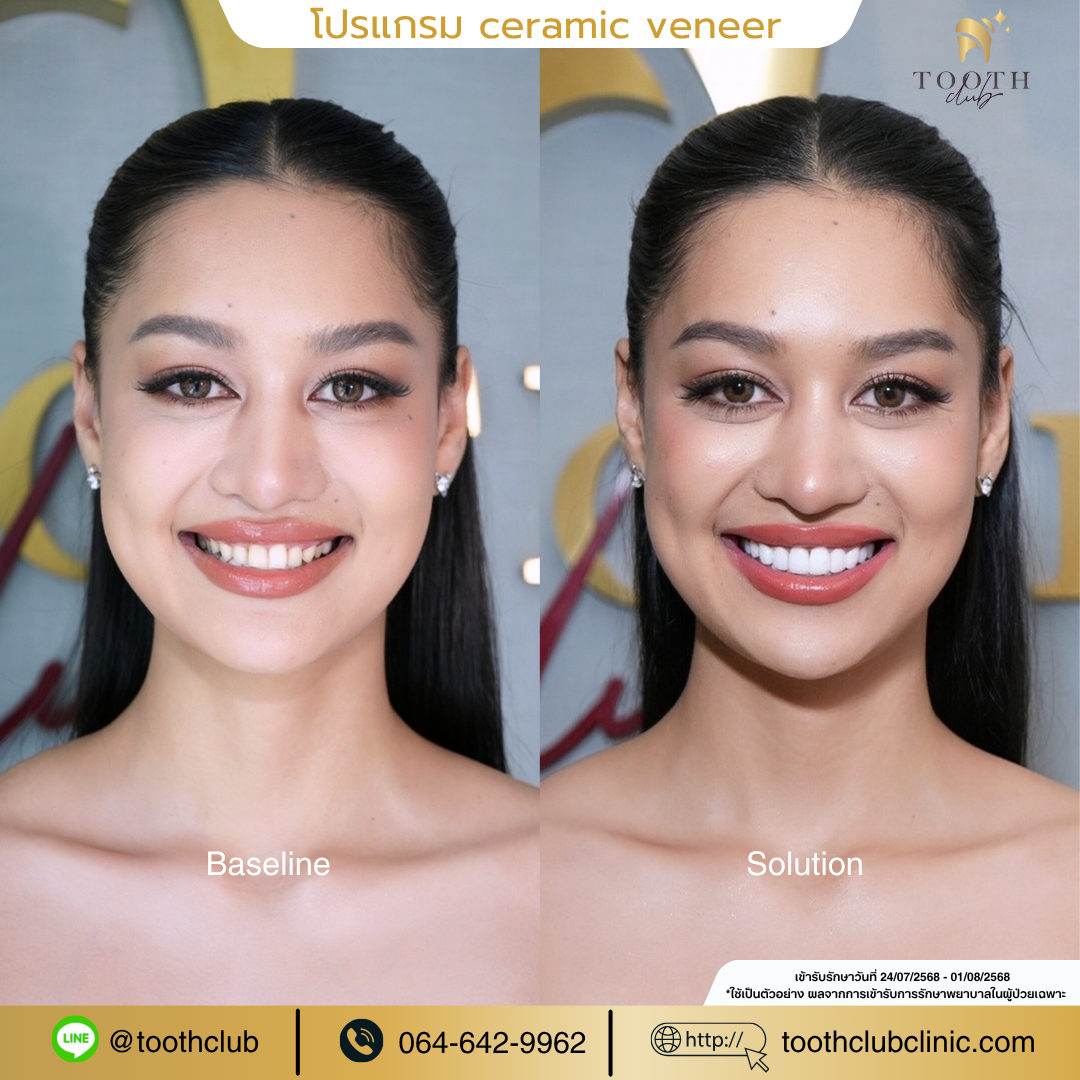 สำเนาของ Black and Purple Futuristic Technology Presentation (13) สำเนาของ Black and Purple Futuristic Technology Presentation (13)